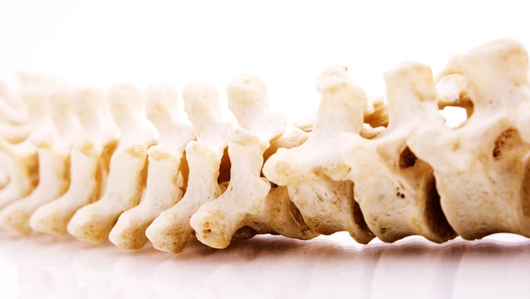 Spondylarthrite ankylosante fléau de la jeunesse (1)