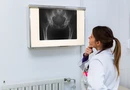 spondylarthrite : un diagnostic urgent, mais difficile (3)